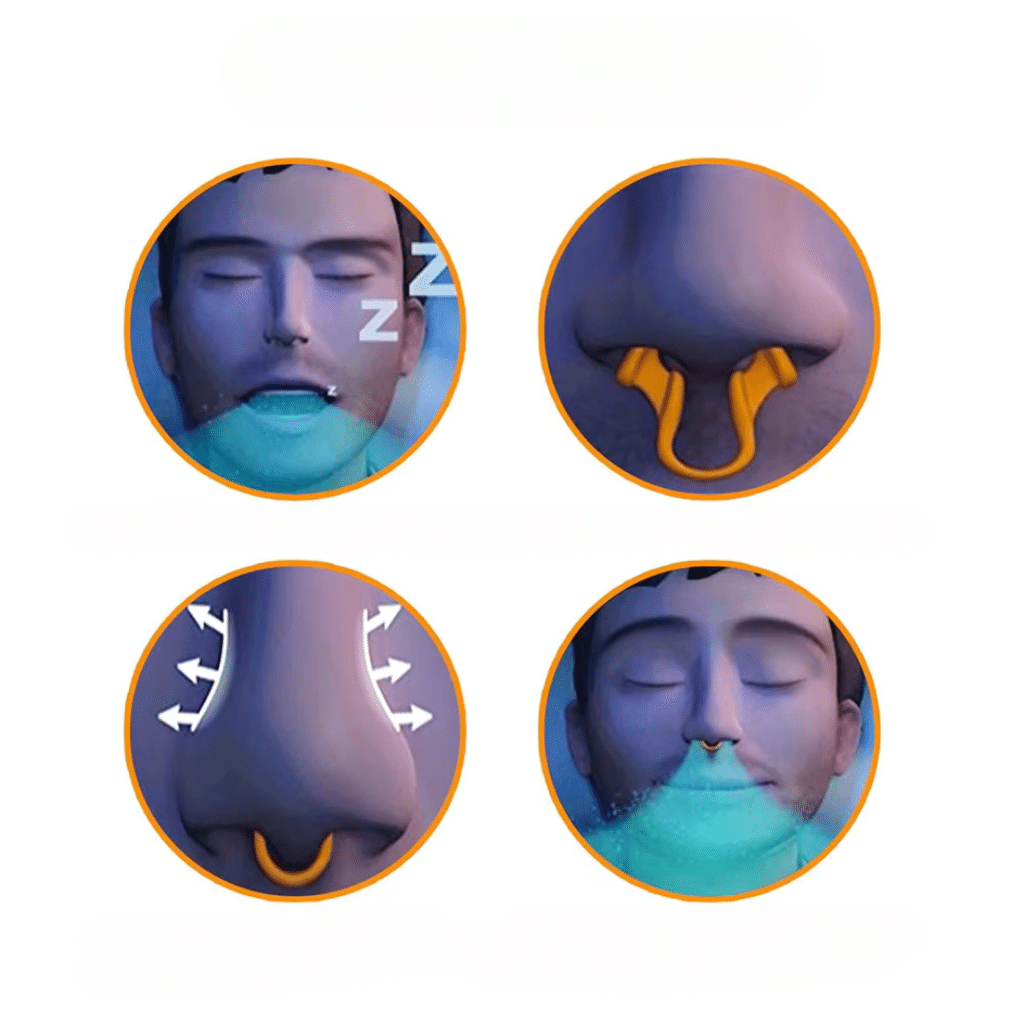 Respyria Nasal Dilator (Official Retailer) [year]